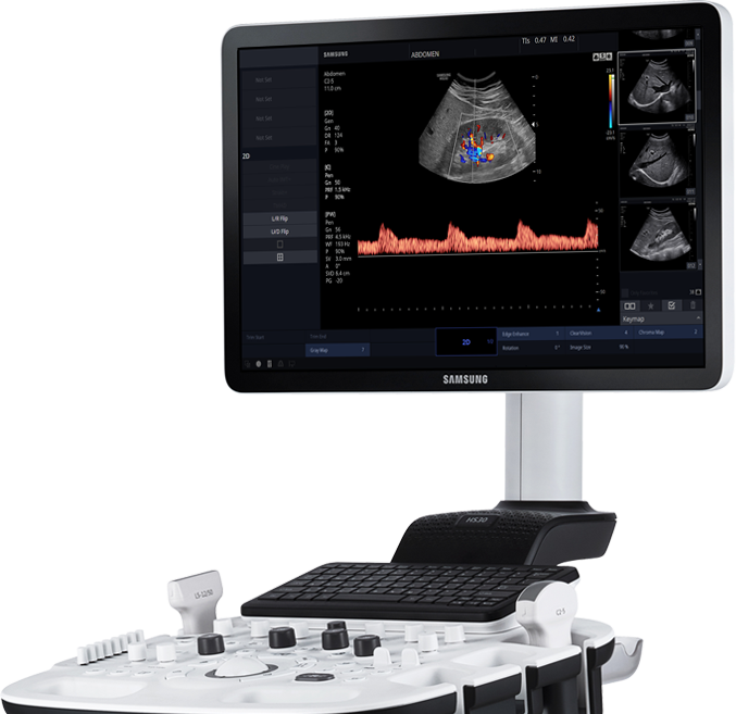 УЗИ аппарат Samsung HS30