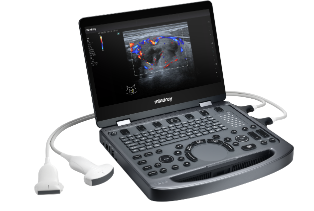 УЗИ аппарат Mindray MX3
