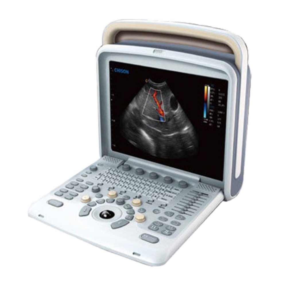 УЗИ аппарат Chison SonoTouch 50