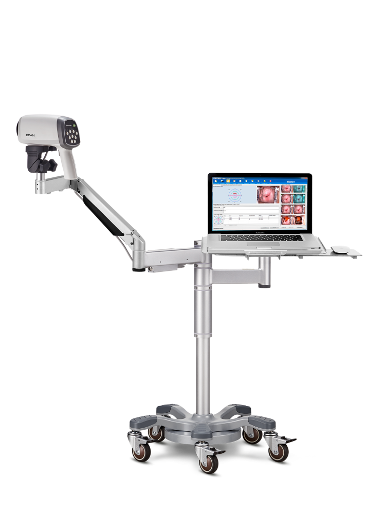 Видеокольпоскоп Edan C6A