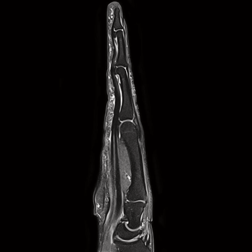 Катушка для визуализации кисти/запястья Siemens Hand/Wrist 16