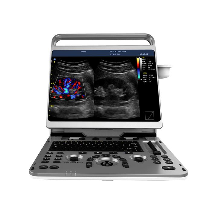 УЗИ аппарат CHISON EBit 50