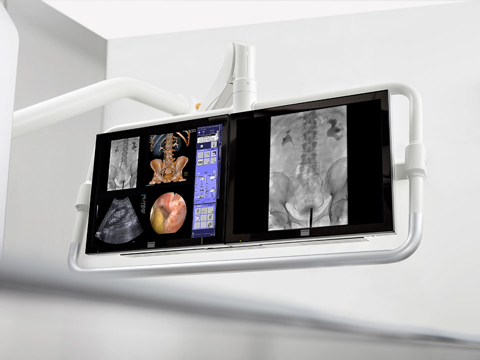 Цифровой рентгеновский аппарат для урологии Siemens Uroskop Omnia Мах