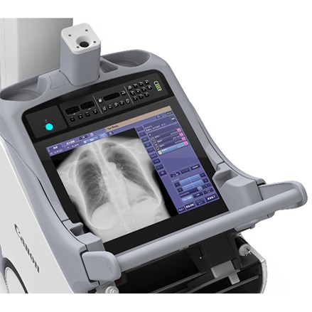 Цифровой палатный рентгеновский аппарат Canon Mobirex i9