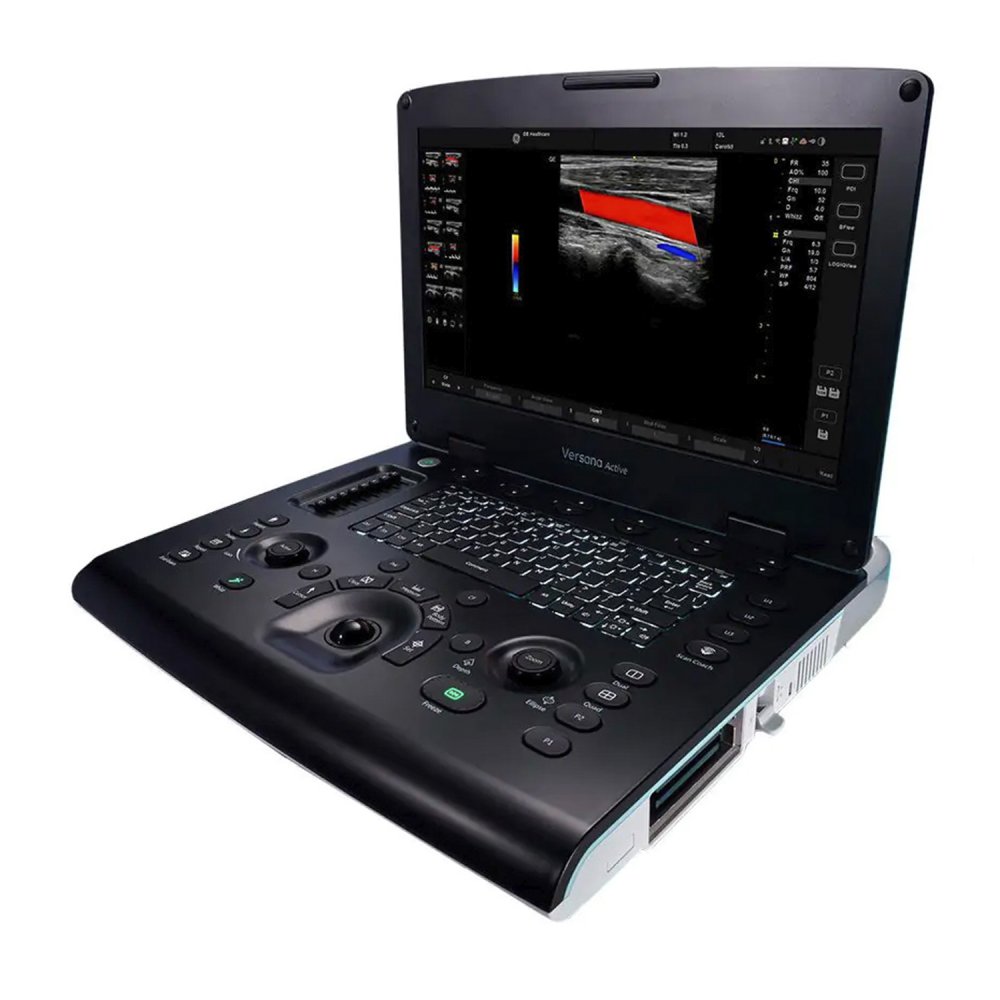 Ультразвуковая система GE Versana Active
