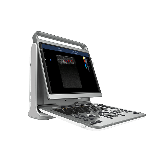 УЗИ аппарат CHISON EBit 50