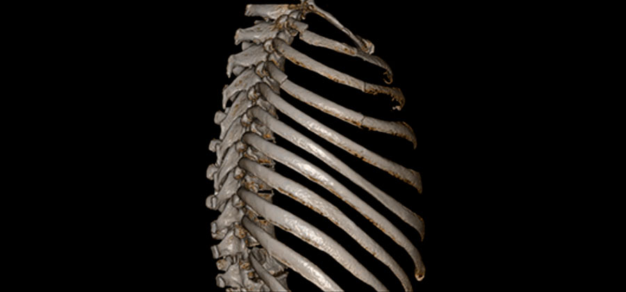 Компьютерный томограф ADVIN Ventum 32S