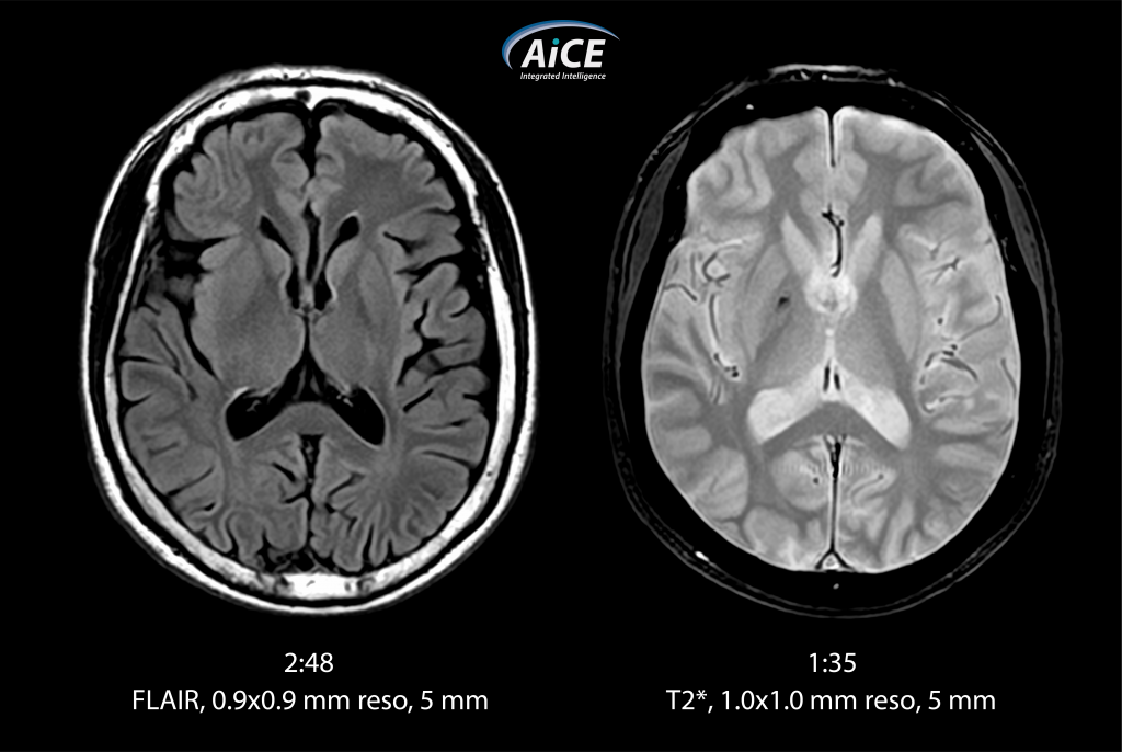 Магнитно-резонансный томограф Canon Vantage Elan 1.5T