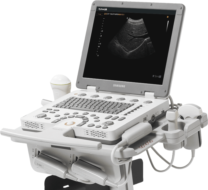 УЗИ аппарат Samsung MySono U6