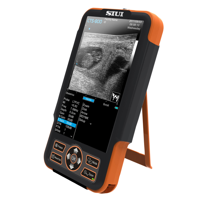 Ветеринарный УЗИ сканер SIUI CTS-800