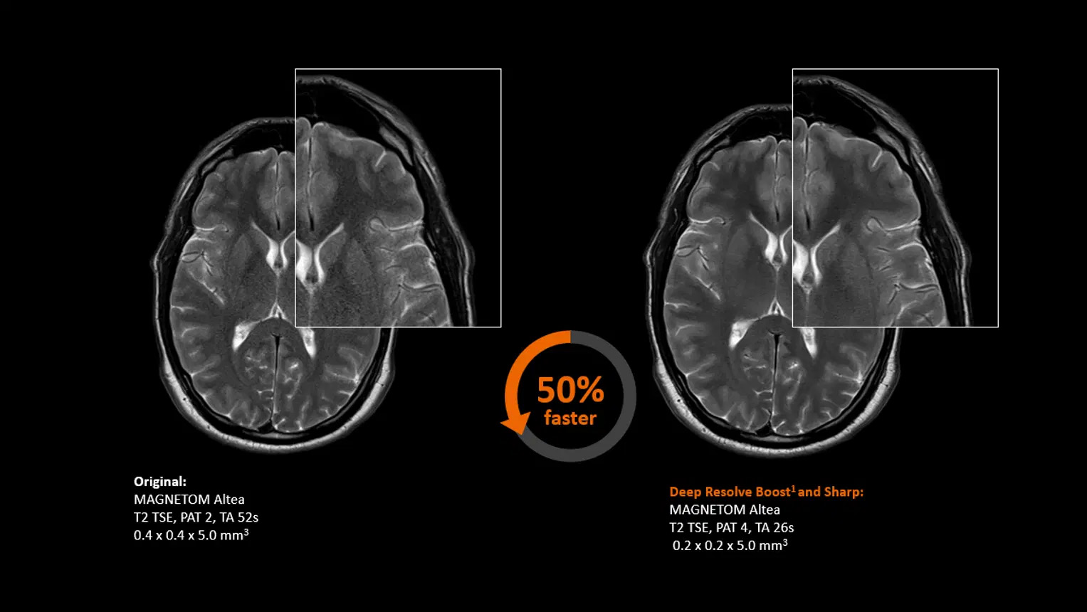 Магнитно-резонансный томограф Siemens MAGNETOM Altea