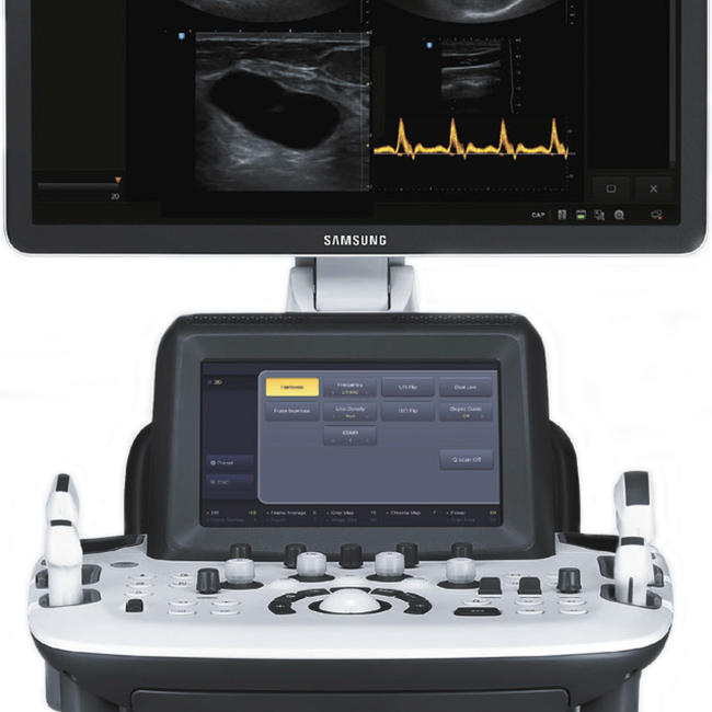 УЗИ аппарат Samsung UGEO H60