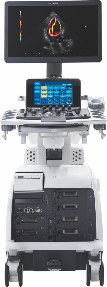 УЗИ аппарат Fujifilm Lisendo 880LE