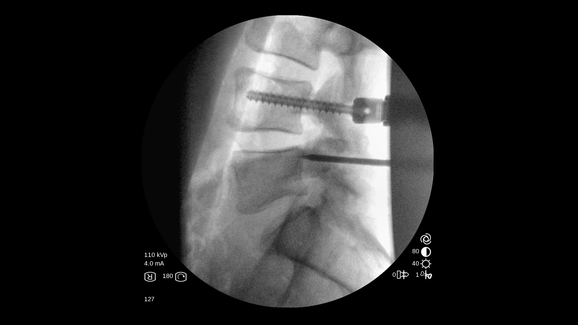 Мобильный рентгеновский аппарат с С-дугой GE OEC One