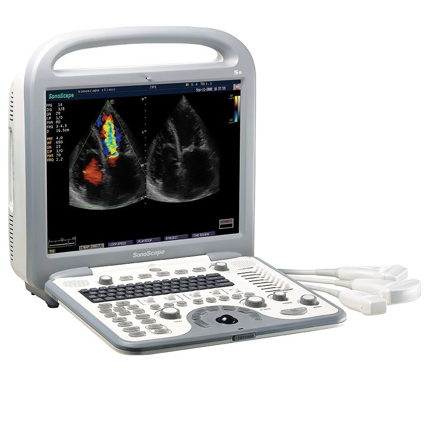 Ультразвуковой аппарат SonoScape S8
