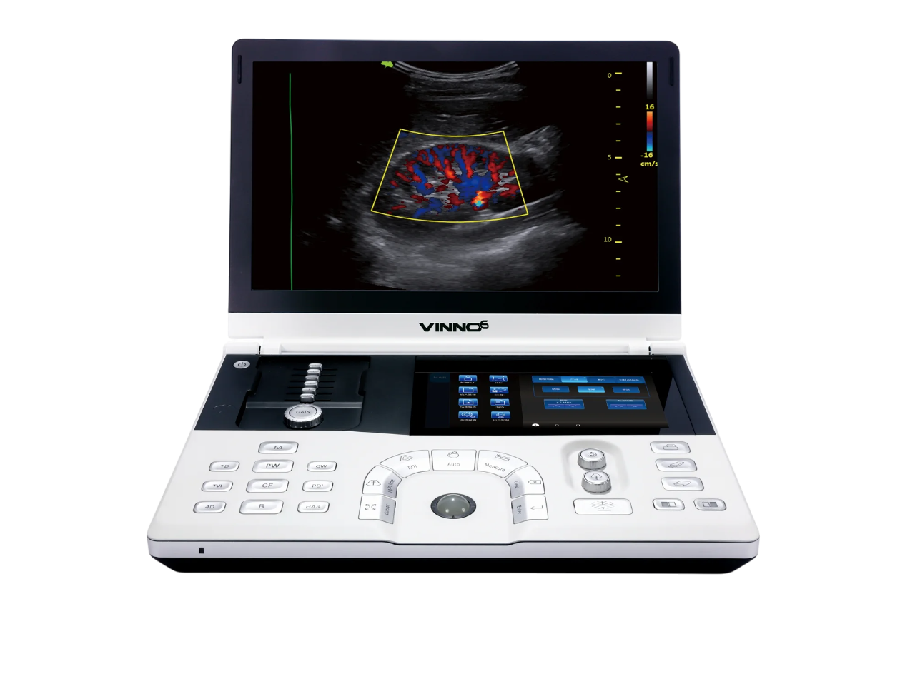 Портативный УЗИ аппарат VINNO 6