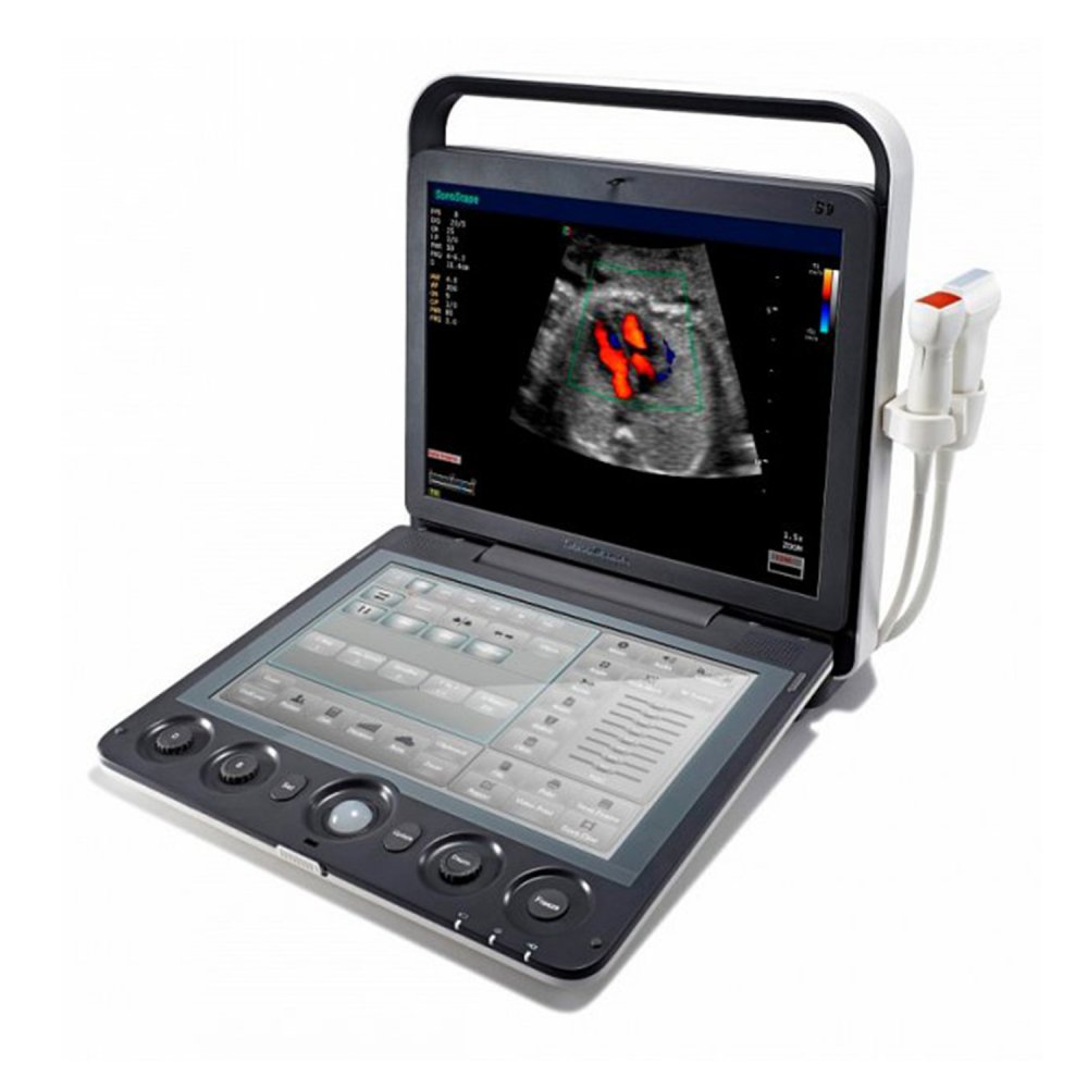 Ультразвуковой аппарат SonoScape S9