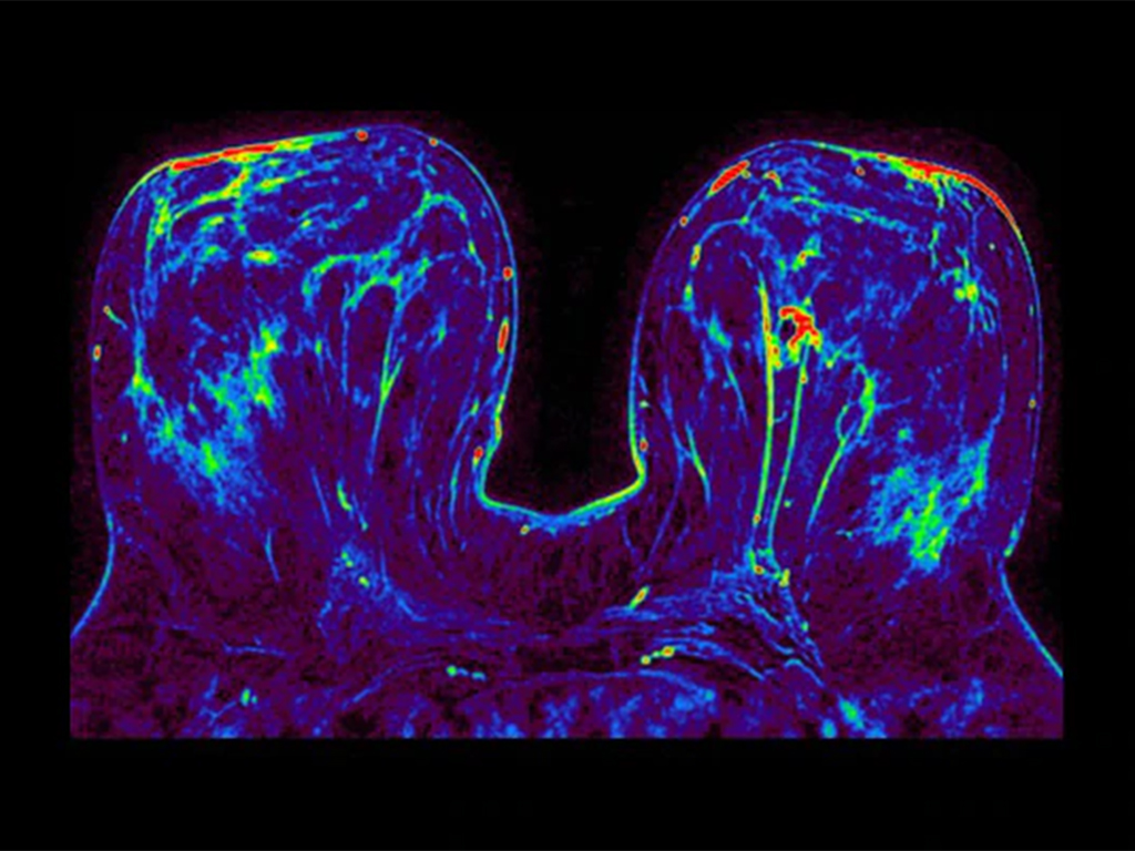 Мультимодальная рабочая станция врача GE SIGNA Works