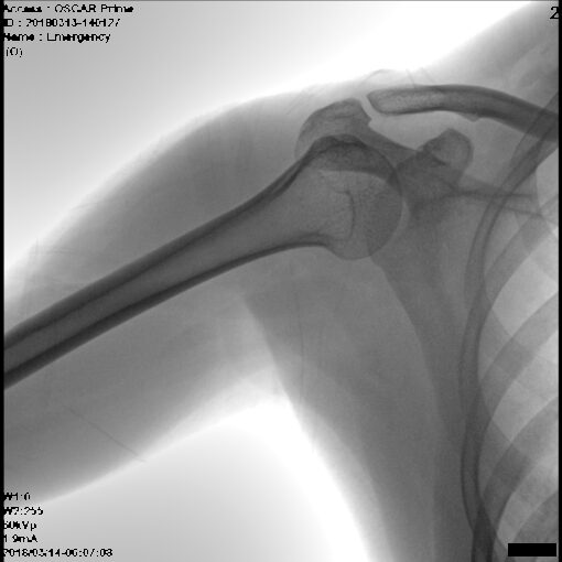 С.П. Гелпик «РЕНЕКС» 5,3 кВт мобильный рентгенохирургический аппарат типа С-дуга с плоскопанельным детектором