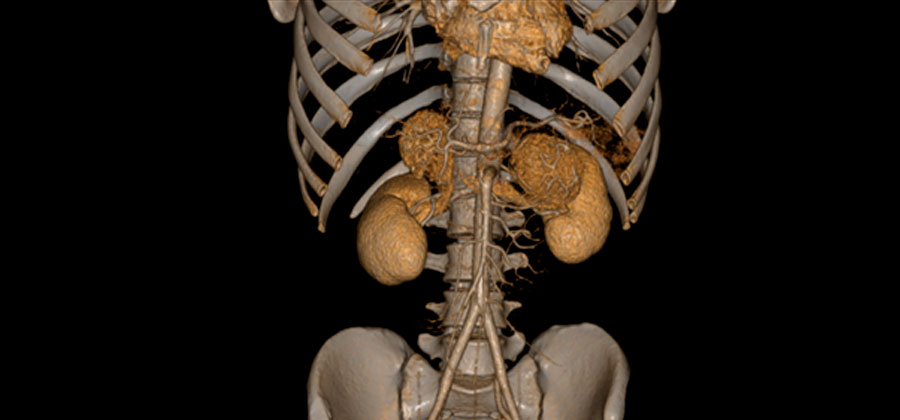 Компьютерный томограф ADVIN Ventum 32S