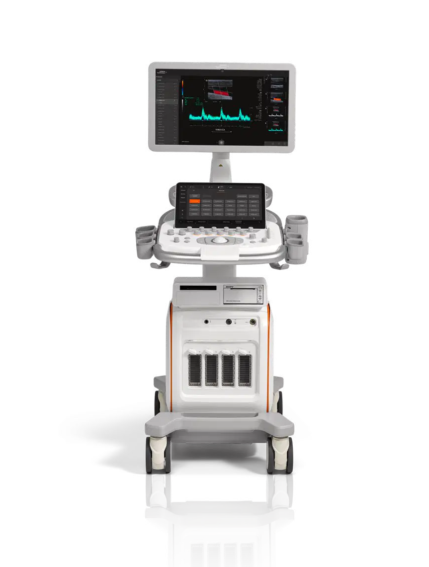 Ультразвуковая система Siemens ACUSON Redwood