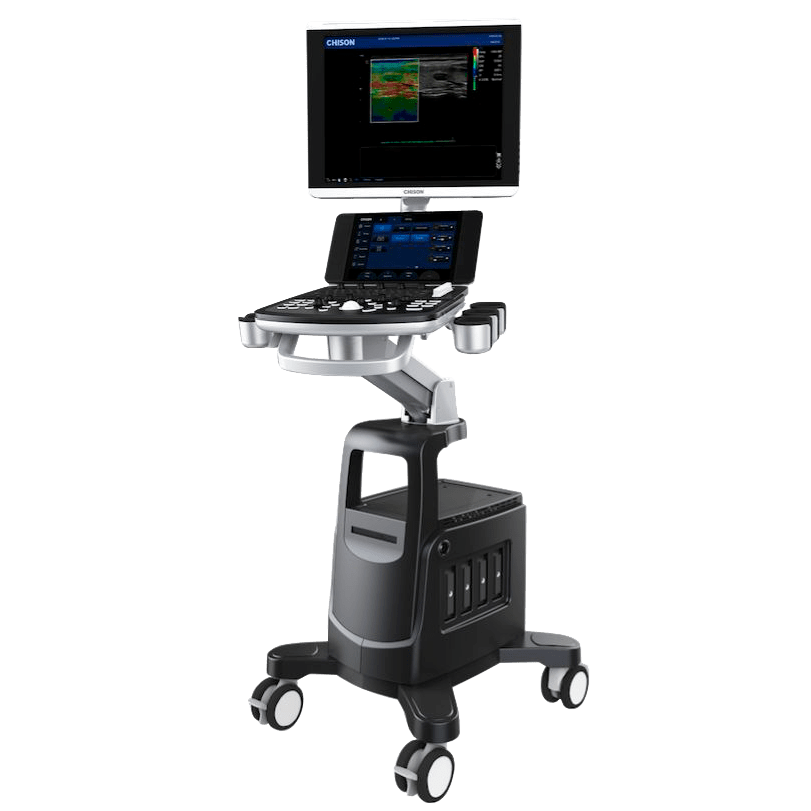 УЗИ-аппарат CHISON Qbit 11 NEW MATRIX