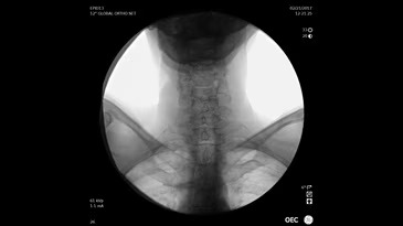 Мобильный рентгеновский аппарат с С-дугой GE OEC Elite