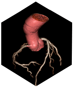 Компьютерный томограф SinoVision Insitum 568