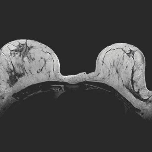 Матричная катушка для молочных желез Siemens Breast Matrix Coil