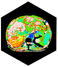 Компьютерный томограф SinoVision Insitum 568