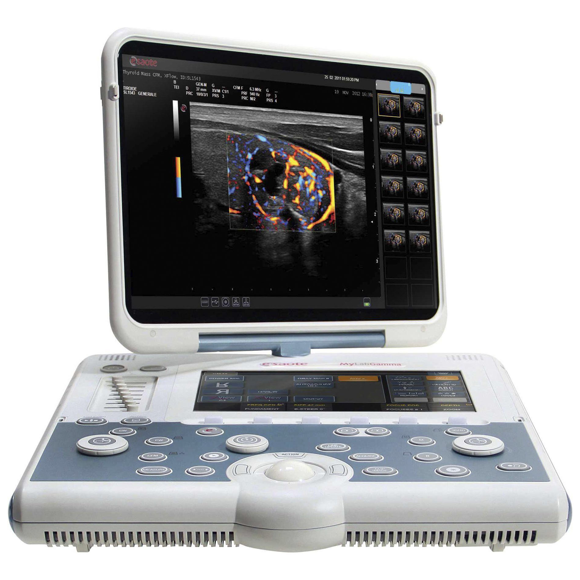 УЗИ аппарат Esaote MyLab Gamma