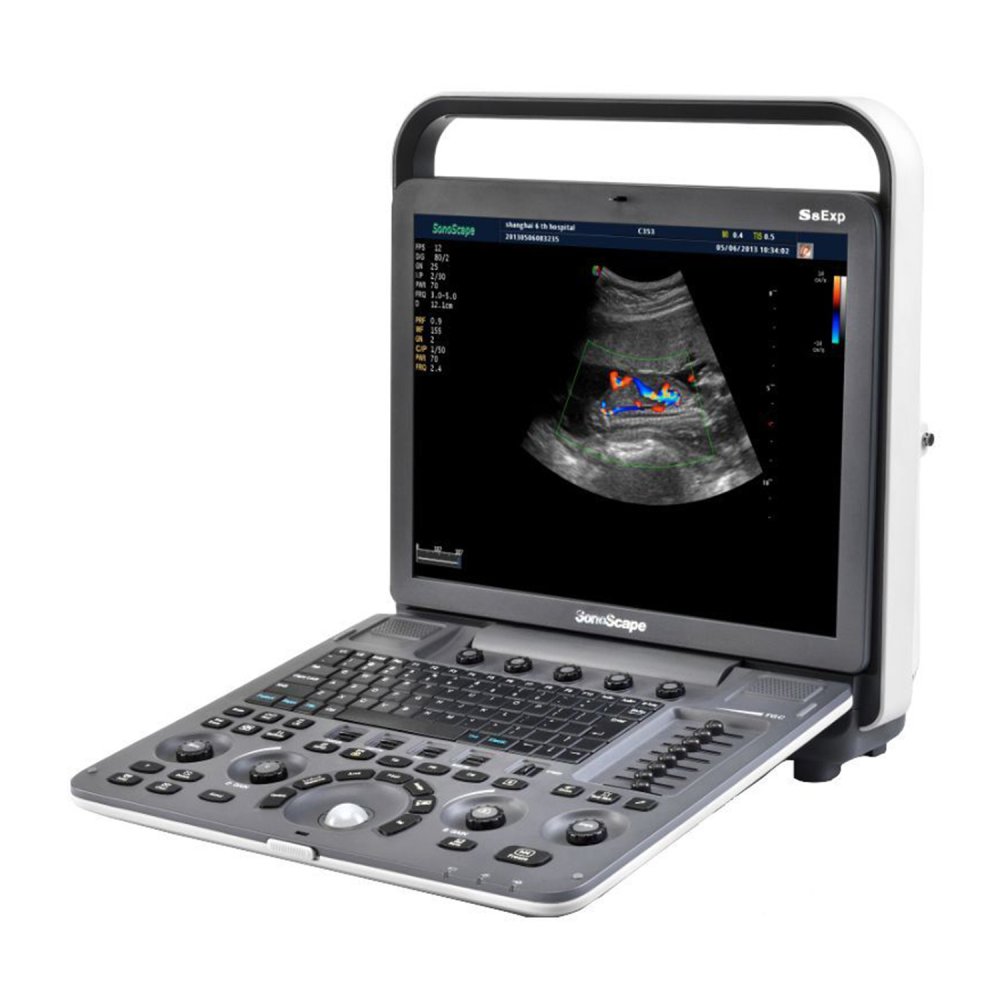 Ультразвуковой аппарат SonoScape S8Exp