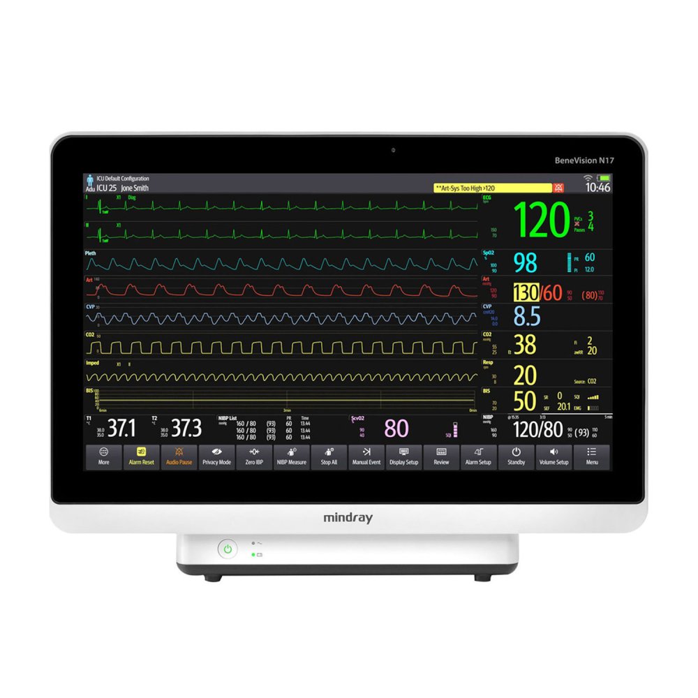 Монитор пациента Mindray BeneVision N17