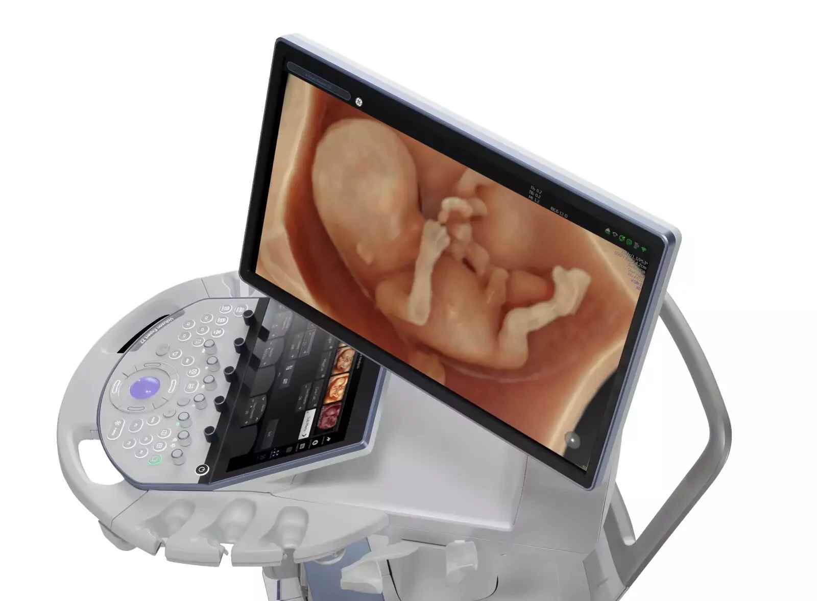 УЗИ аппарат GE HealthCare Voluson Expert 22