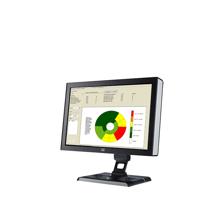 ПО для магнитно-резонансного анализа желудочков Esaote CAAS MRV