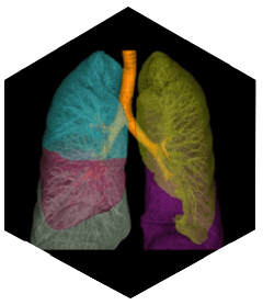 Компьютерный томограф SinoVision Insitum 568