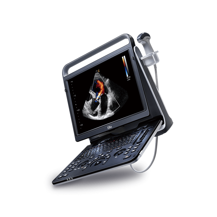 УЗИ аппарат CHISON EBit 60