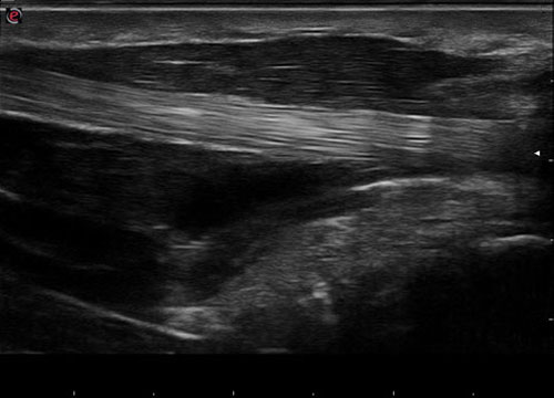 УЗИ аппарат Esaote MyLab Gamma