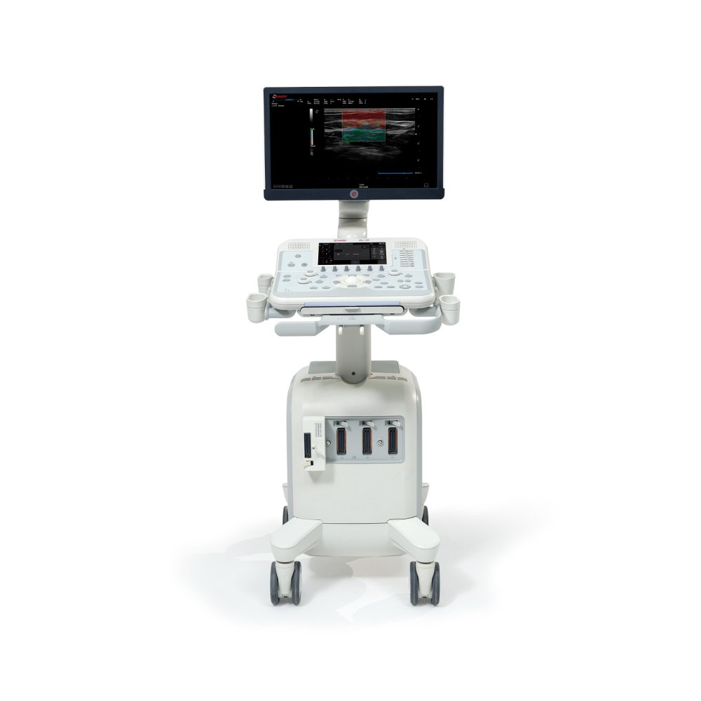 УЗИ аппарат Esaote MyLab X6