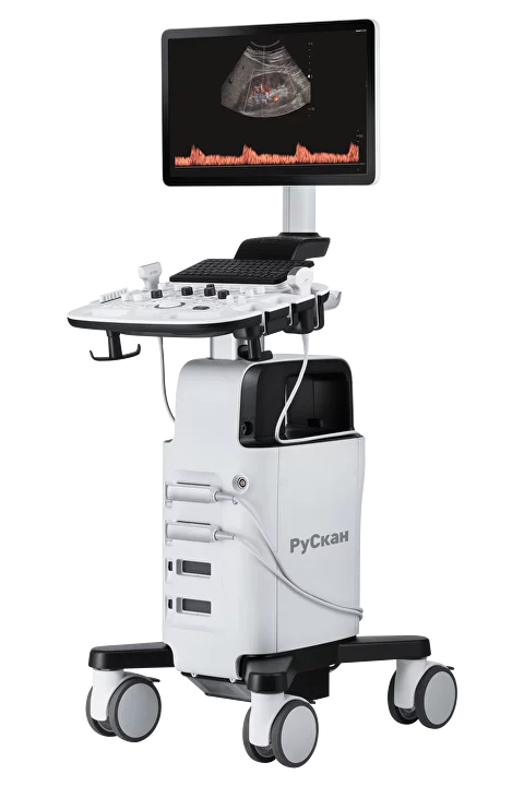 УЗИ аппарат РуСкан 50