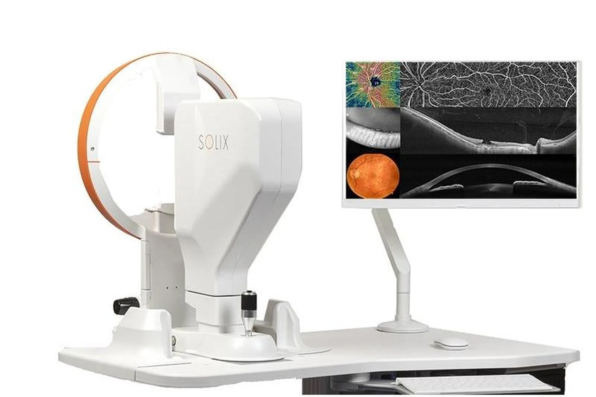 Optovue SOLIX