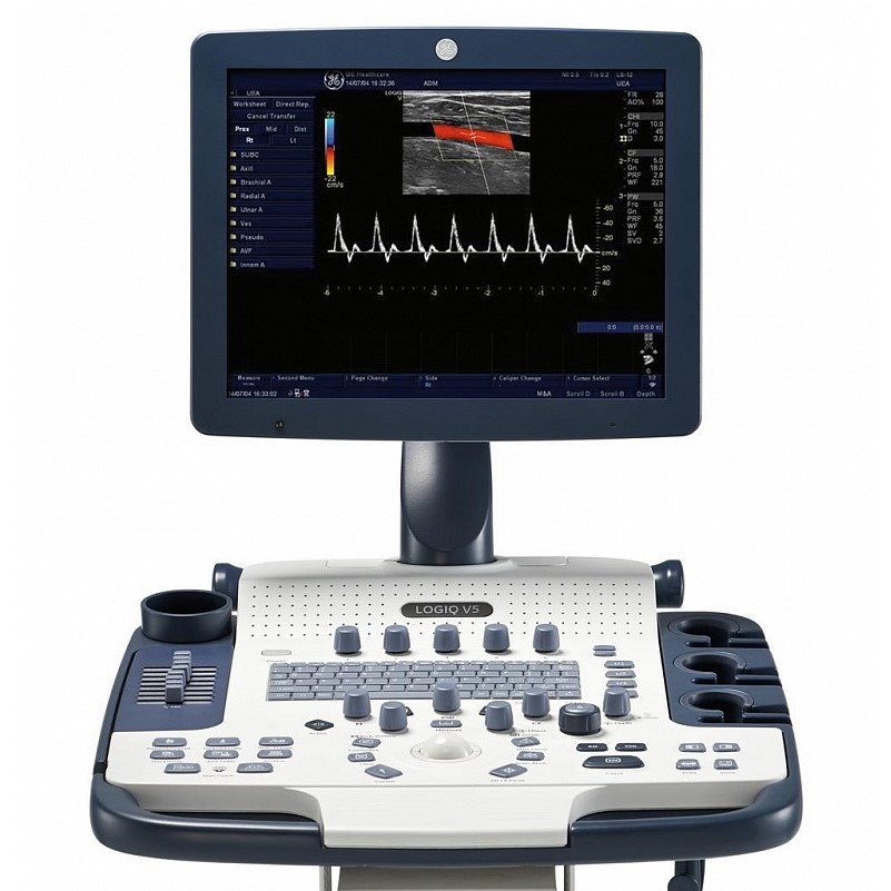 Ультразвуковая диагностическая система GE Healthcare LOGIQ V5