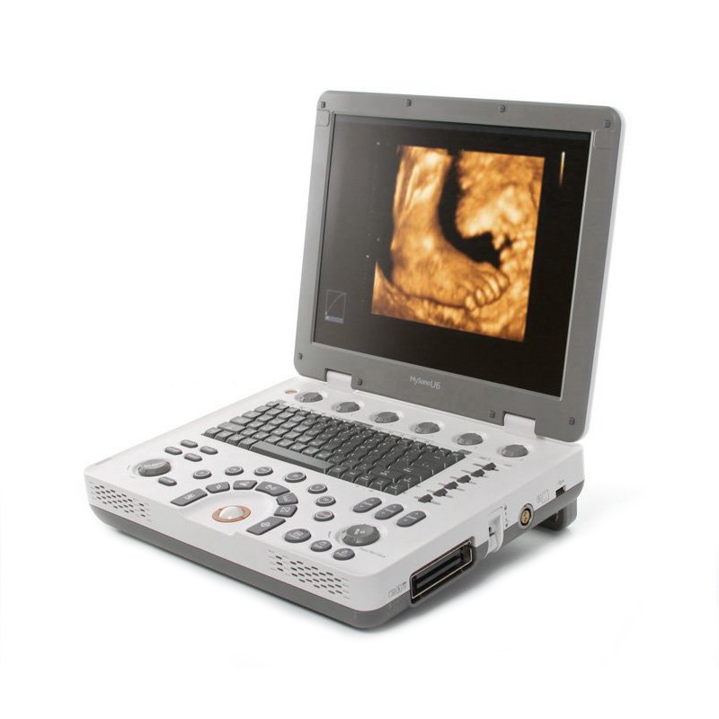 УЗИ аппарат Samsung MySono U6