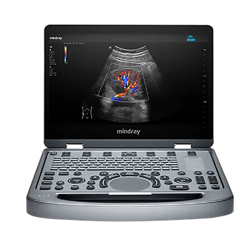 УЗИ аппарат Mindray MX3