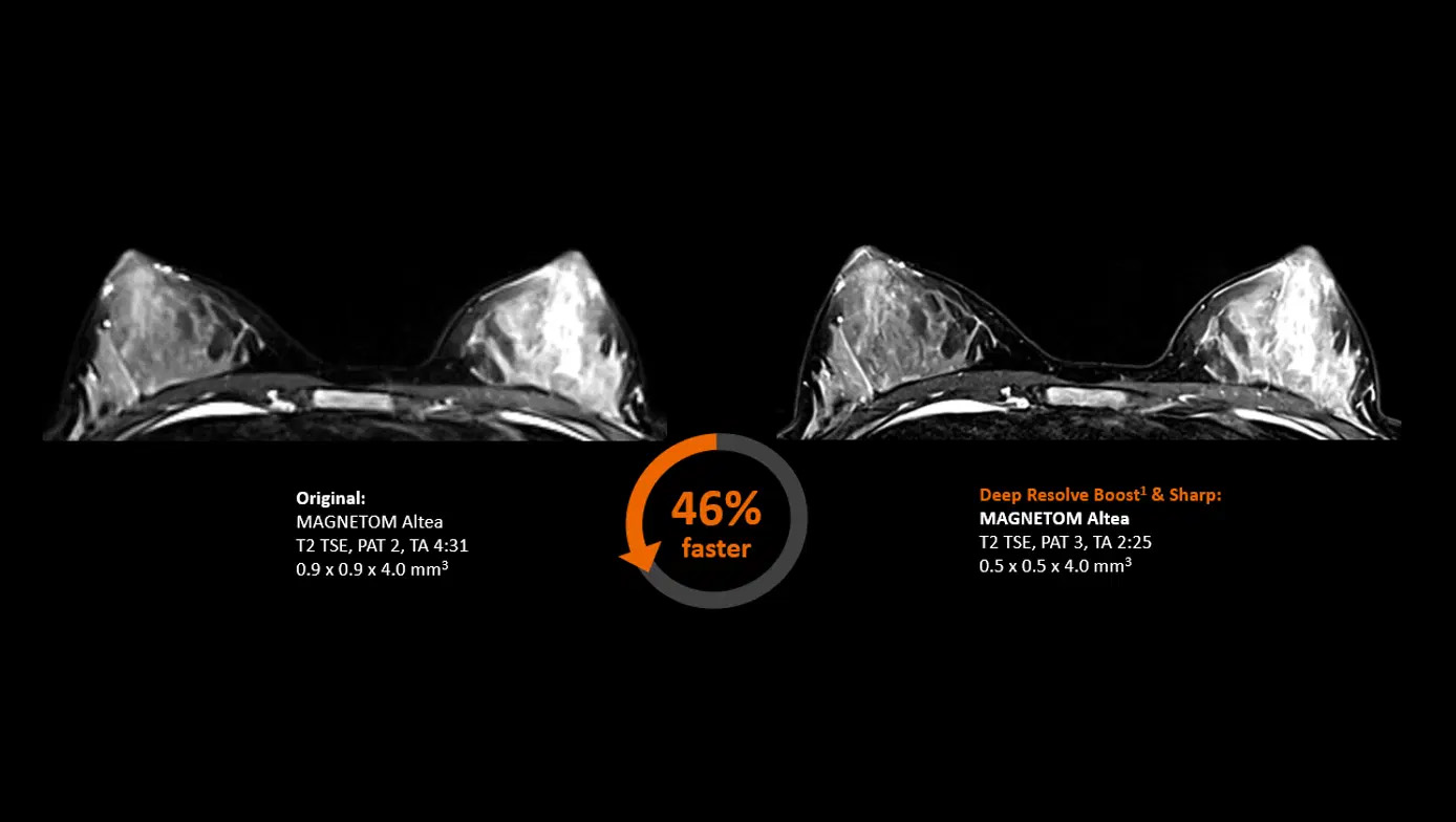 Магнитно-резонансный томограф Siemens MAGNETOM Altea