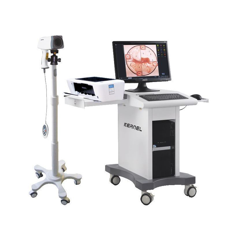 Видеокольпоскоп Kernel KN-2200