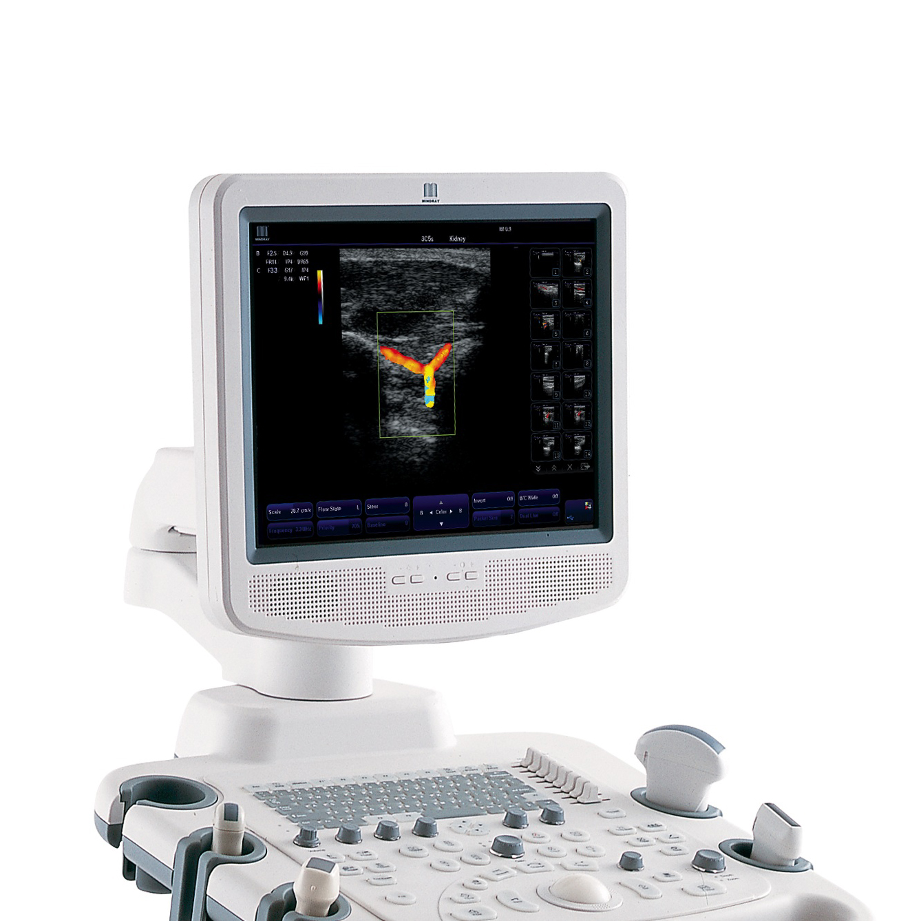 УЗИ аппарат Mindray DC-3