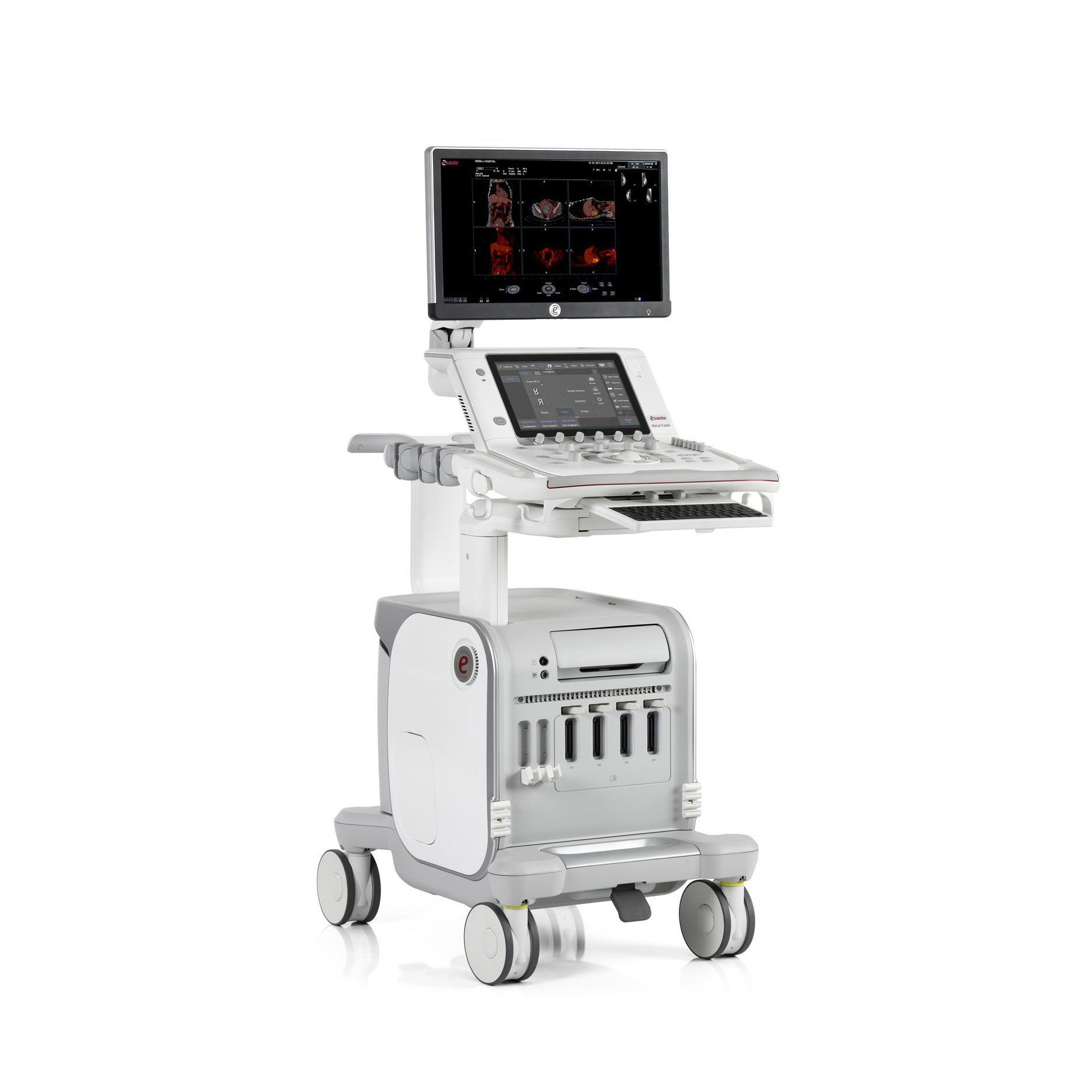 УЗИ аппарат Esaote MyLab 9