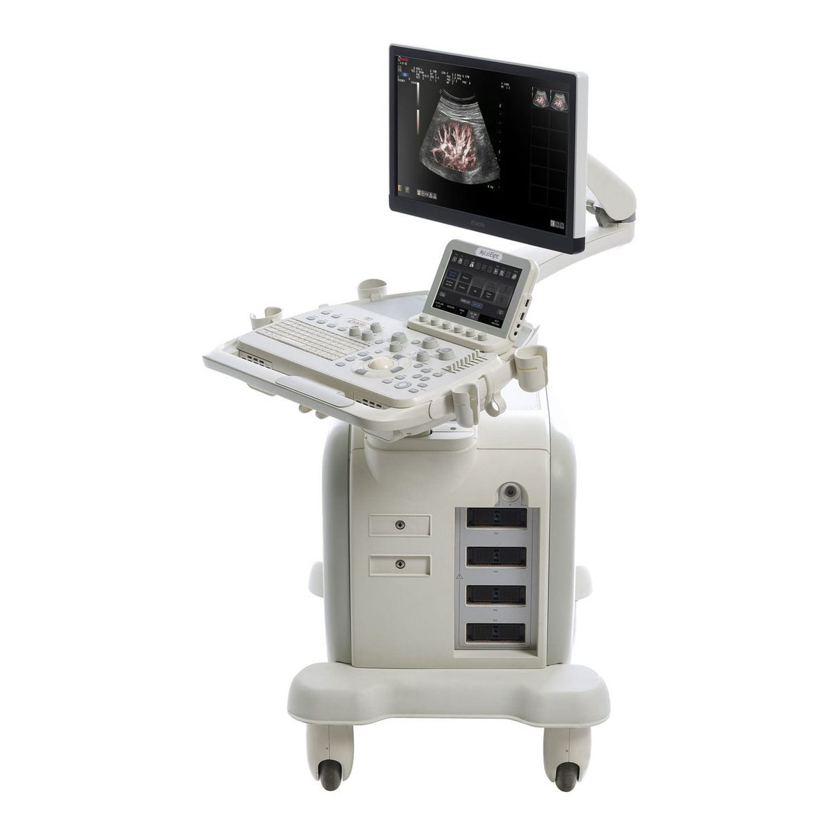 УЗИ аппарат Esaote MyLab Eight