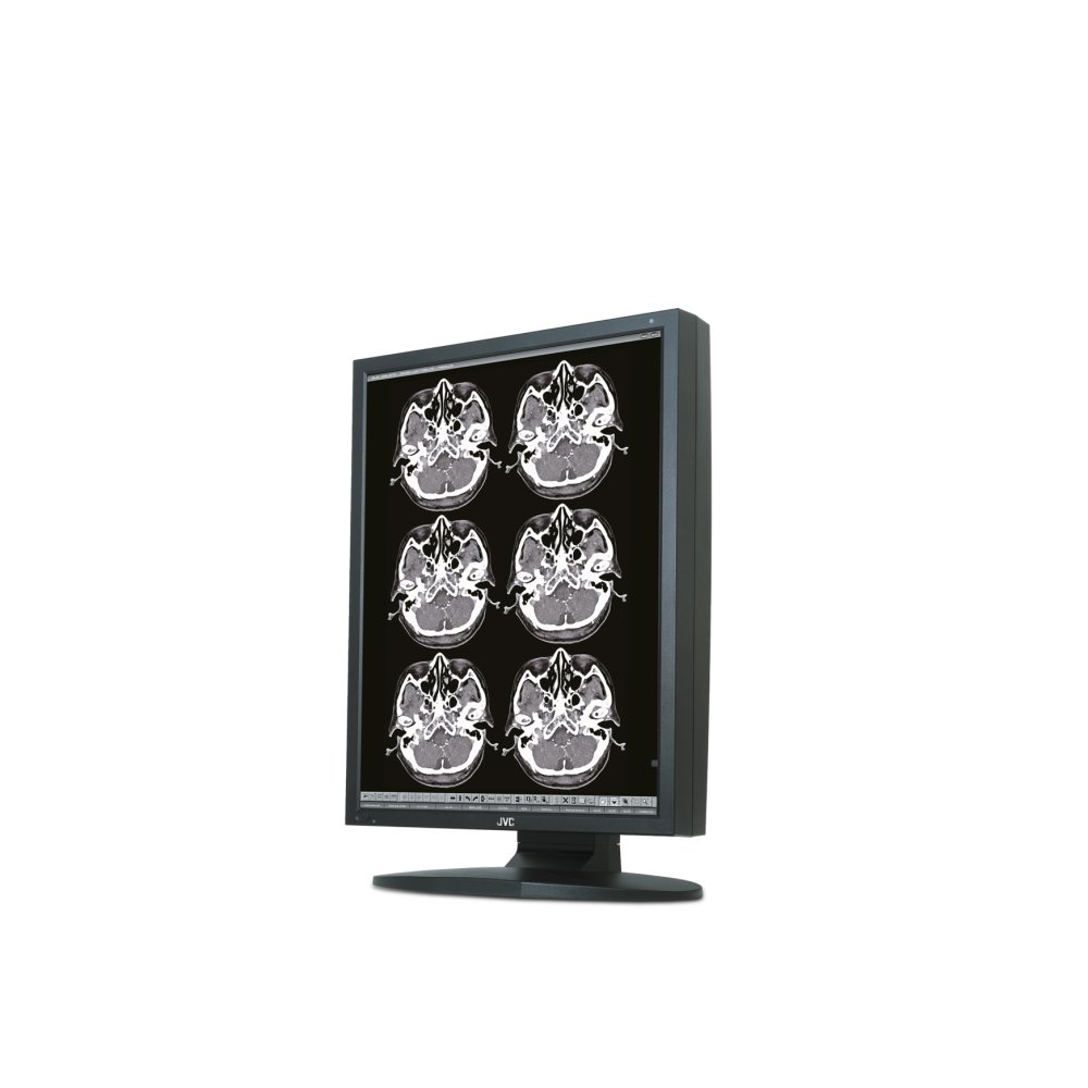 Медицинский монитор JVC MS25i2